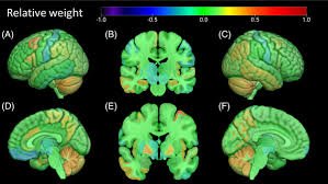 Regional Adiposity and Brain Aging Chart