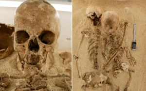 Ancient DNA Reveals Rare Dwarfism
