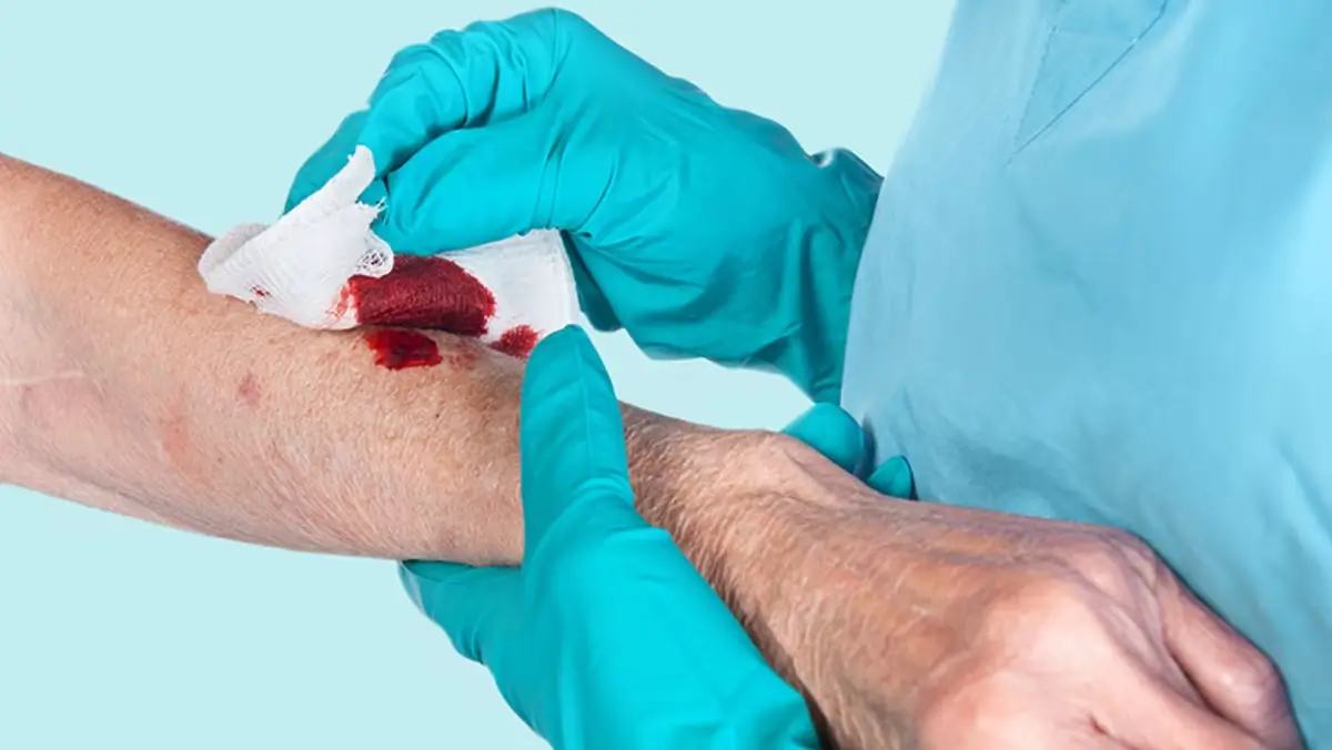New Medical Powder Can Halt Heavy Bleeding in Seconds